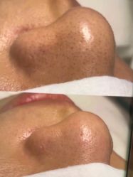 -skin79皮肤管理中心