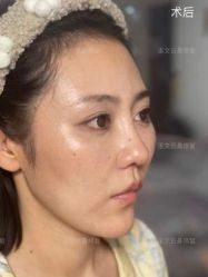 -北京米扬丽格医疗美容·联合丽格鼻整形中心