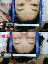 -颜和骨正·明哲式骨相美学整骨