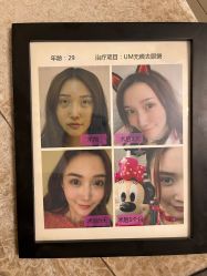 体验前-紫洁俪方（北京）医疗美容