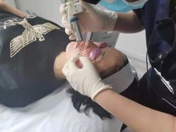 体验前-东剑医学美容·注射美学中心