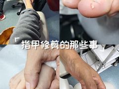 -新甲连锁灰指甲·甲沟炎·鸡眼(黑龙江路店)