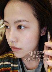 -洁铭新加坡医美