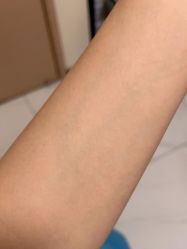 体验后-深圳鹏爱悦心医疗美容医院