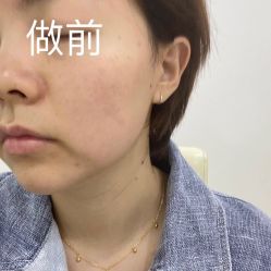 点击看大图 体验前-重庆联合丽格第五医疗美容医院