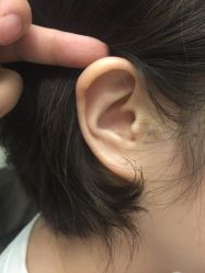-肥三针腧穴瘦身馆