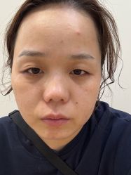 -北京画美医疗美容医院