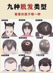 -诗碧曼养发