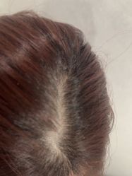 -熙朵美学植发·连锁品牌