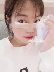 体验后-上海漾颜医疗美容