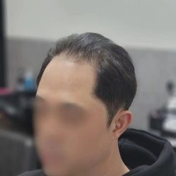 点击看大图 -LAQUEEN 时尚健康假发