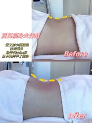 -AURAS璈然科技护肤中心