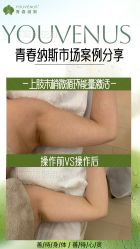 -半岛故事·法儿曼抗衰·indiba中心
