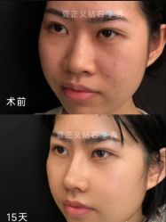 -北京米扬丽格医疗美容·联合丽格鼻整形中心
