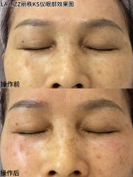 -丽锦汇LA LIZZ丽秩·科技美肤