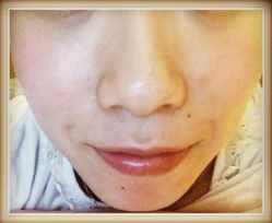 -SKINIST丽铂医疗美容