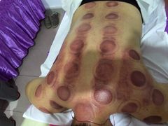 -益友堂盲人推拿正骨穴位按摩工作室