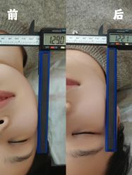 -颜和骨正·明哲式骨相美学整骨