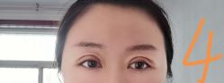 点击看大图 -八大处整形