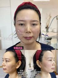 -Yestar重庆艺星医疗美容医院