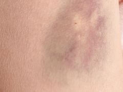 -上海市第五人民医院