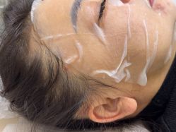 -长沙雅美医疗美容医院