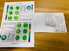 -上海大学附属上海和平眼科医院
