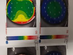 -杭州明视康眼科医院