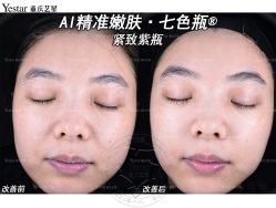 -Yestar重庆艺星医疗美容医院