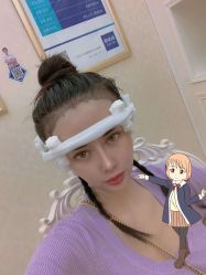 -大麦微针植发丨全国连锁