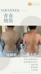 -半岛故事·法儿曼抗衰·indiba中心