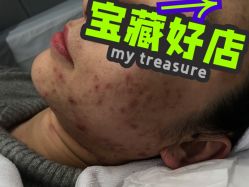 -元熙兰积皮肤管理