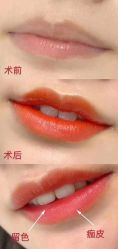 点击看大图 -西施无菌半永久纹绣眉眼影唇轻增发纹发际线