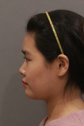 -北京米扬丽格医疗美容·联合丽格鼻整形中心