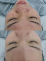 体验前-SKIN79皮肤管理中心