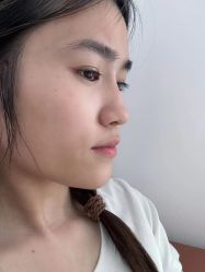-Yestar 嘉兴艺星医疗美容医院