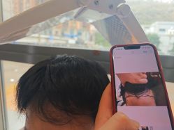 -碧莲盛·不剃发植发