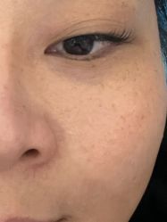 体验后-武汉颜范薇美医疗美容门诊部