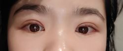 -广州美莱医疗美容医院