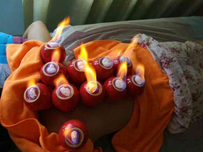 第一次来,我做了个肩颈魔灸,做完肩膀好舒服啊!