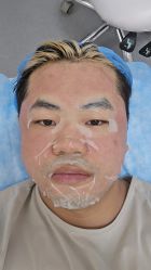 -agge蛋白医美