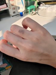 -秦好山专业洗纹身