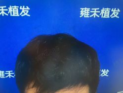 -雍禾植发全国连锁