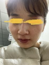 -大华韩艺整形美容医院