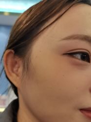 -长沙雅美医疗美容医院