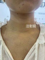 体验前-武汉五洲整形外科医院