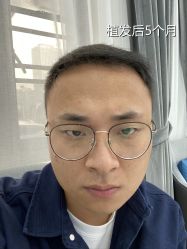 -雍禾植发全国连锁