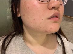 -上海市皮肤病医院(武夷路院区)