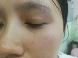 -DJ beauty科技皮肤管理