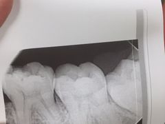 拍片-上海市杨浦区牙病防治所